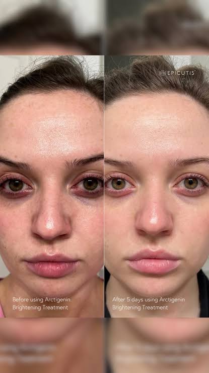 Epicutis Arctigenin Brightening Treatment 30ml
