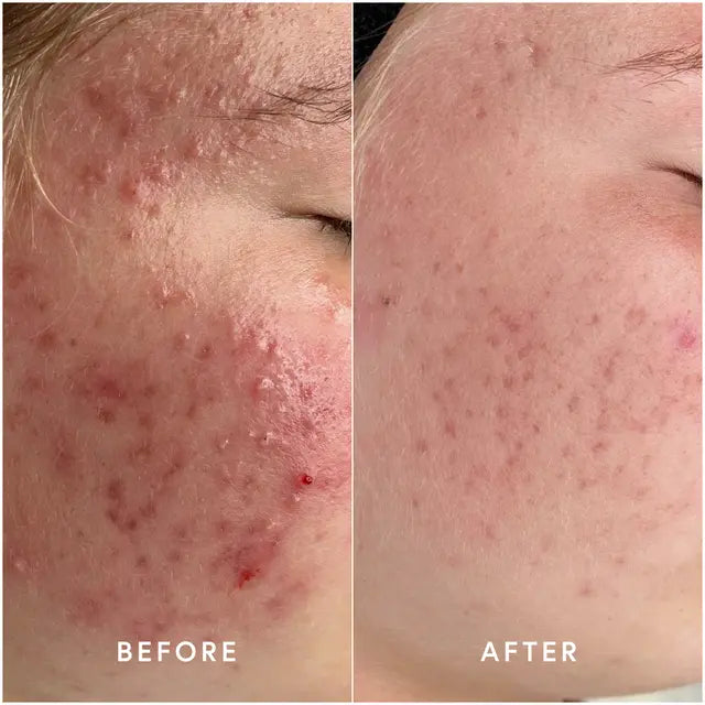 Epicutis Oil Cleanser 120ml