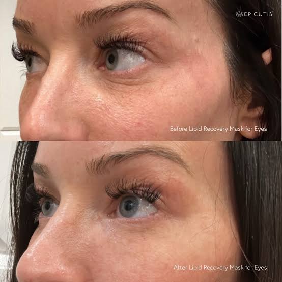 Epicutis Lipid Recovery Eye Masks (Luxury Box 5)