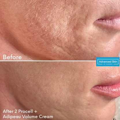 Adipeau Volume Cream 60ml