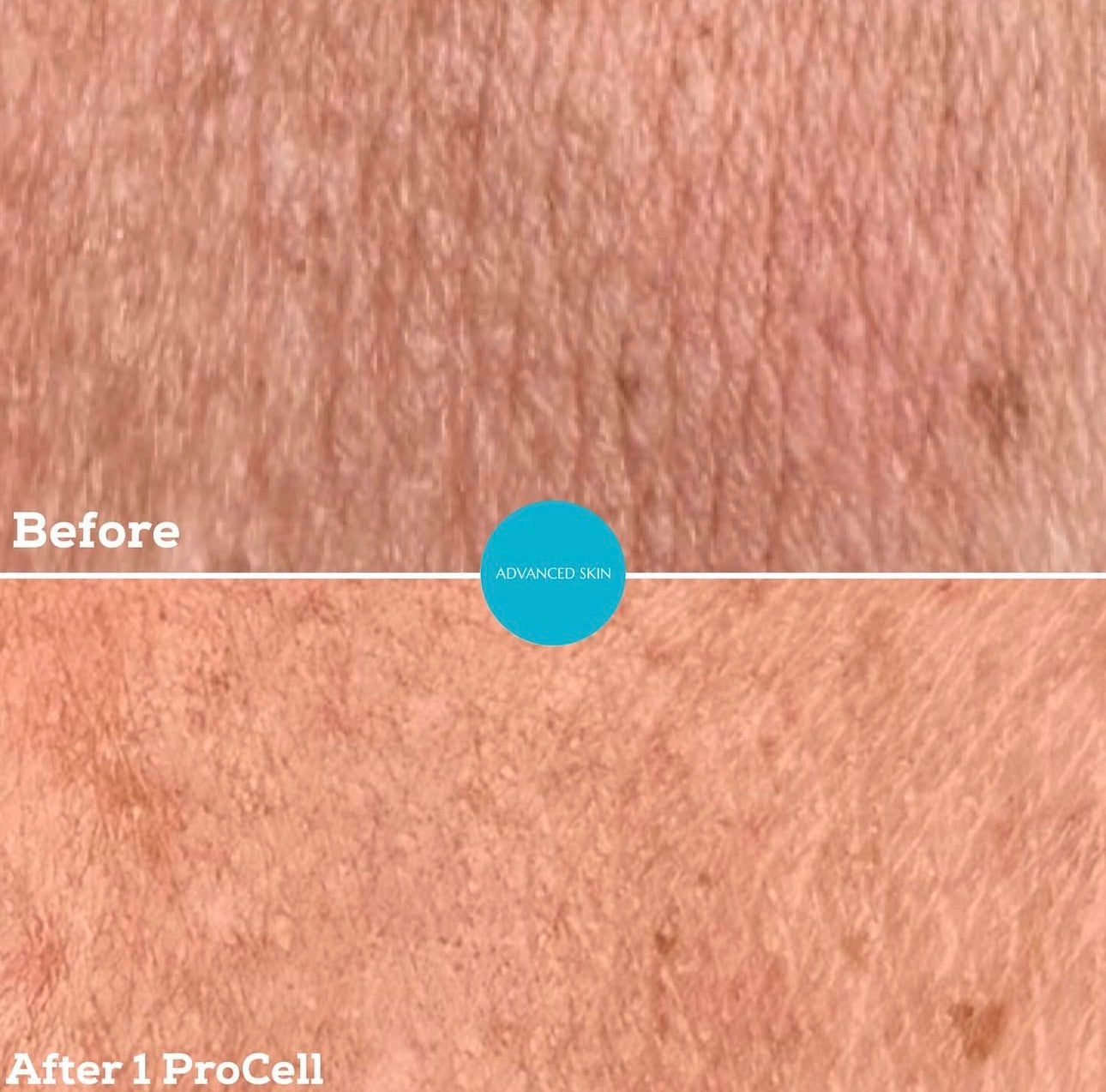 ProCell MD Step 1 & 2 Serums Cellar Renewal + Healing Accelerator