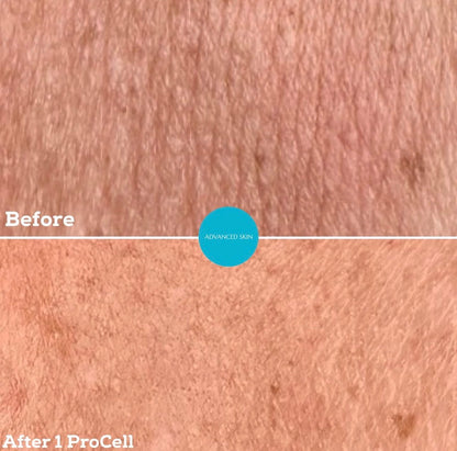 ProCell MD Step 1 & 2 Serums Cellar Renewal + Healing Accelerator