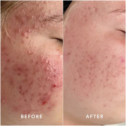 Epicutis Oil Cleanser 120ml