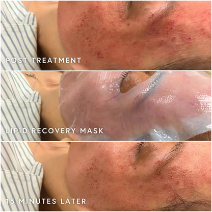 Epicutis Lipid Recovery Face Mask
